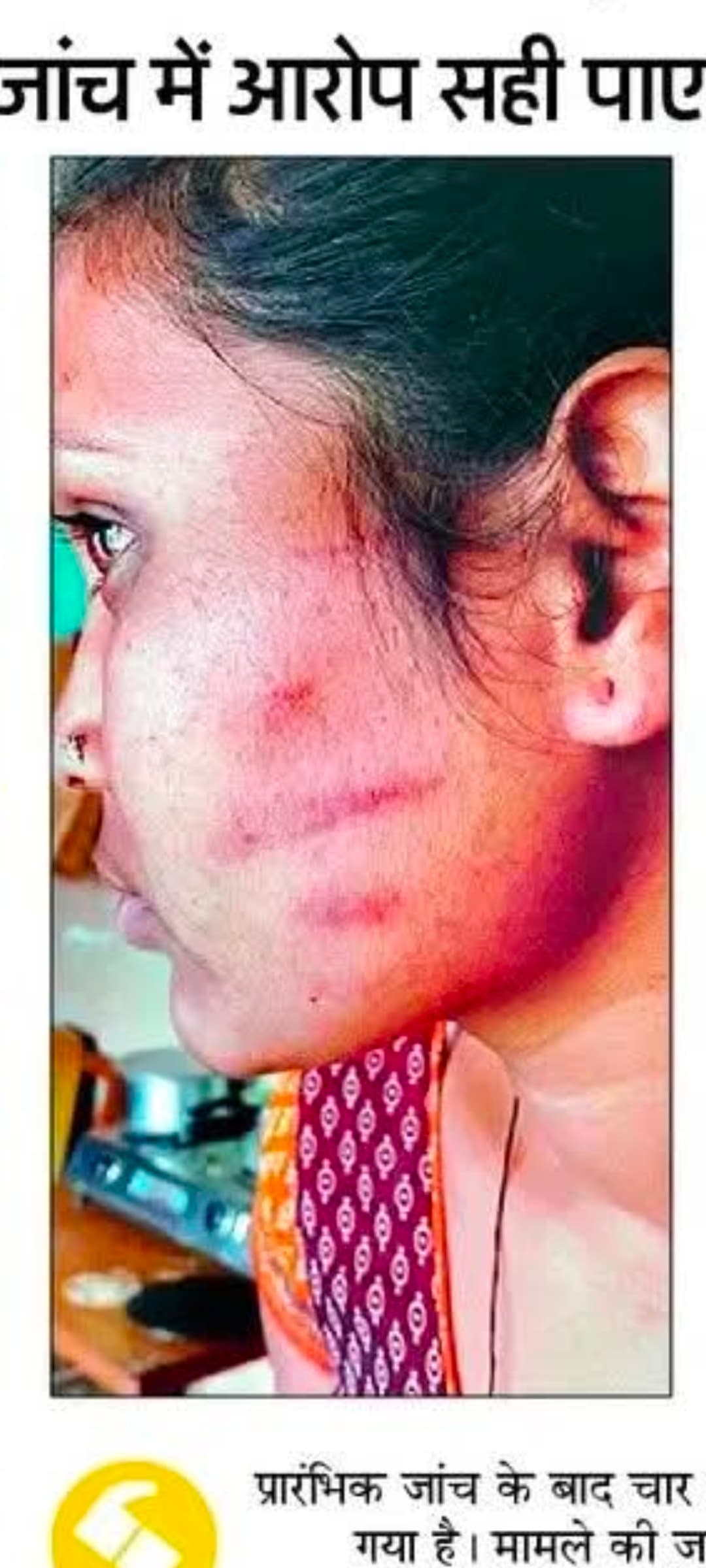 गोरखपुर के बेलघाट थाने में महिला से मारपीट का आरोप, दरोगा समेत