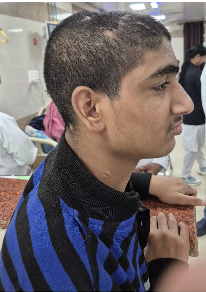 लखनऊ फोटो देखिए कहीं आपका परिचित तो नहीं यह लावारिस किशोर किंग