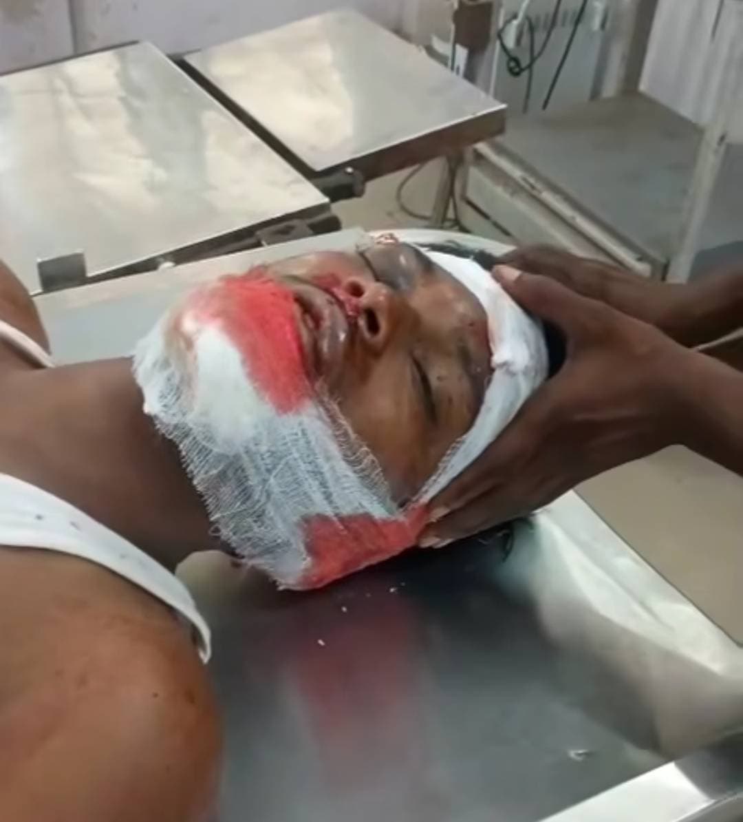 ई-रिक्शा से भिड़ी बाइक, युवक गंभीर रूप से घायल रुद्रपुर (देवरिया)। रुद्रपुर-पिड़रा