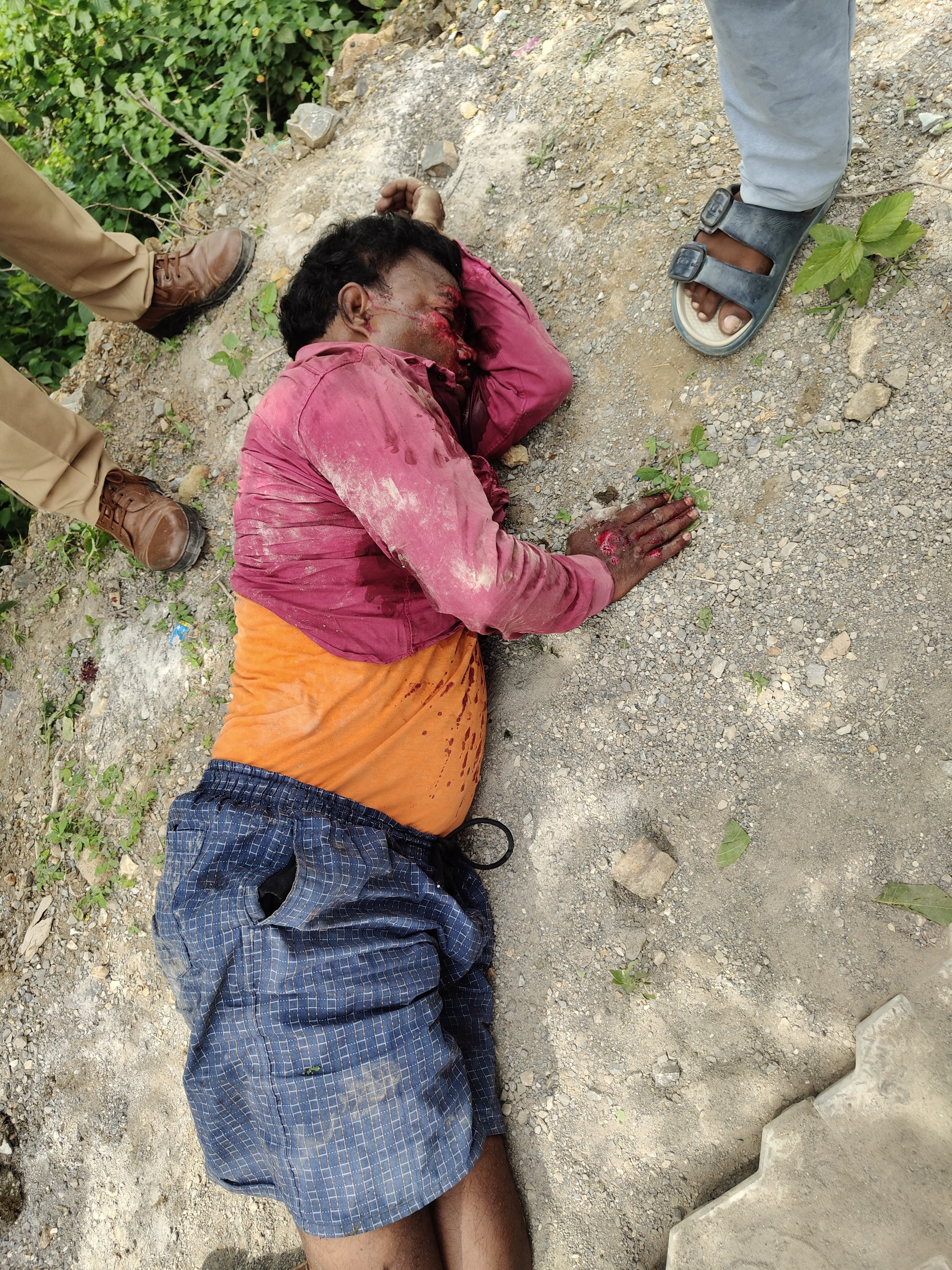 डाला–ओबरा संपर्क मार्ग पर बाइक सवार घायल, 108 एंबुलेंस से अस्पताल भेजा गया